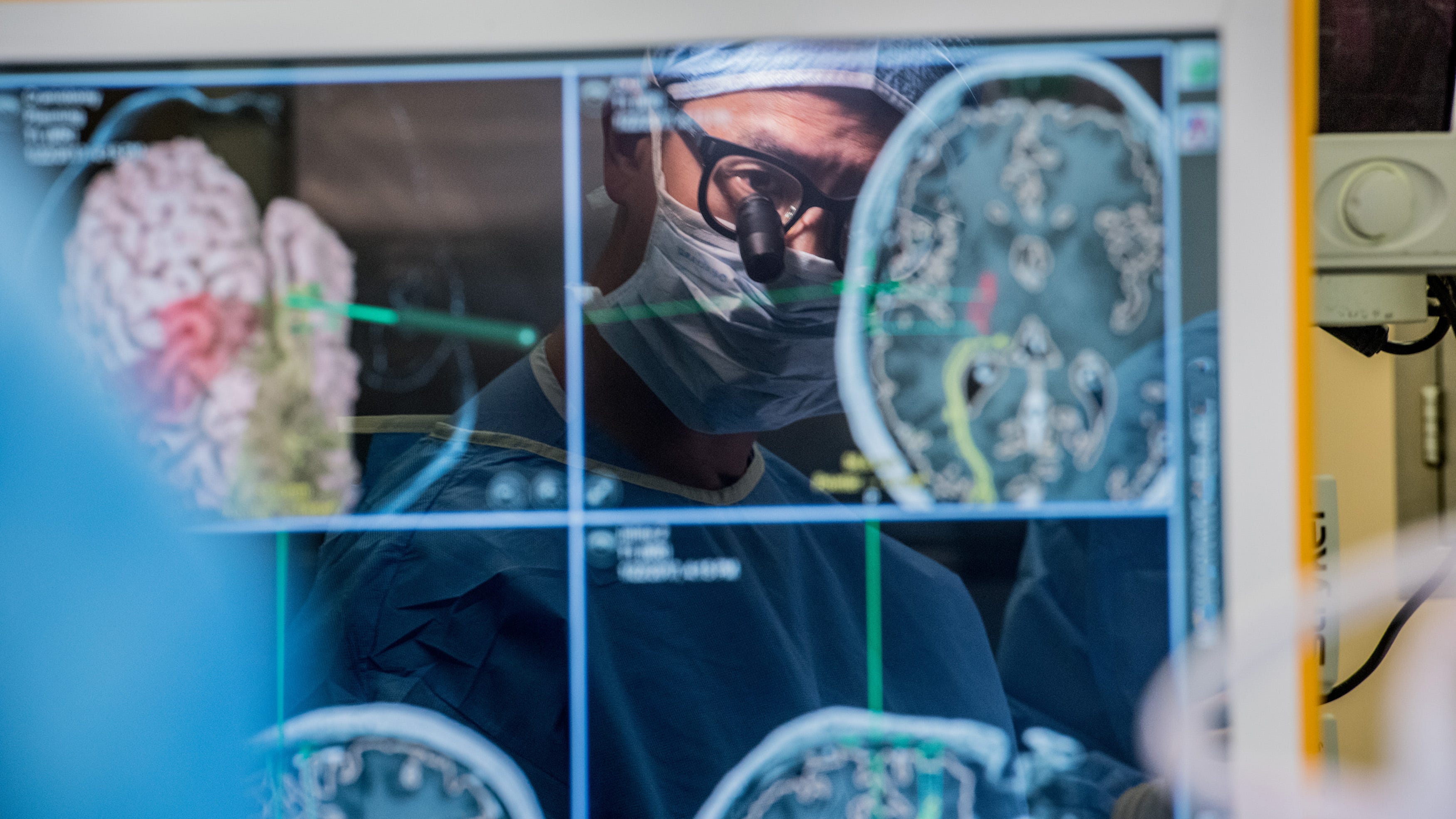 Groundbreaking study: UCSF researchers help paralyzed man translate thoughts to writing