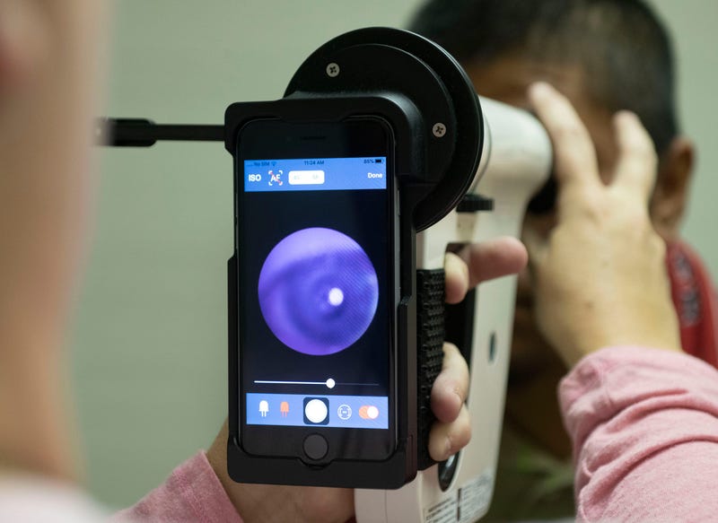An optometry assistant uses an IRIS portable retinal scanner to check the patient for diabetic retinopathy