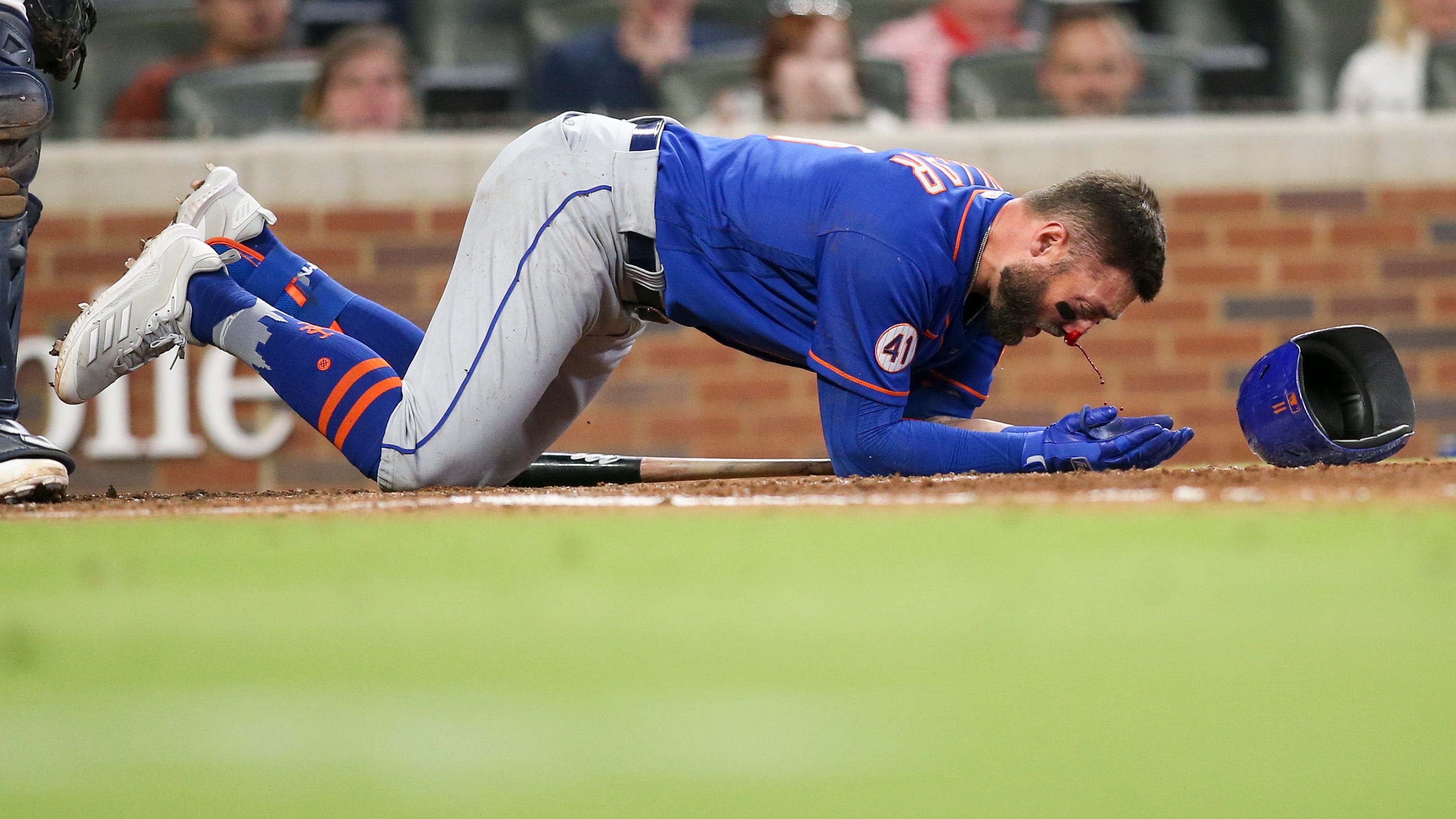 MLB hit-by-pitch epidemic is out of control