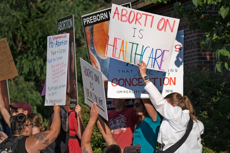 Abortion