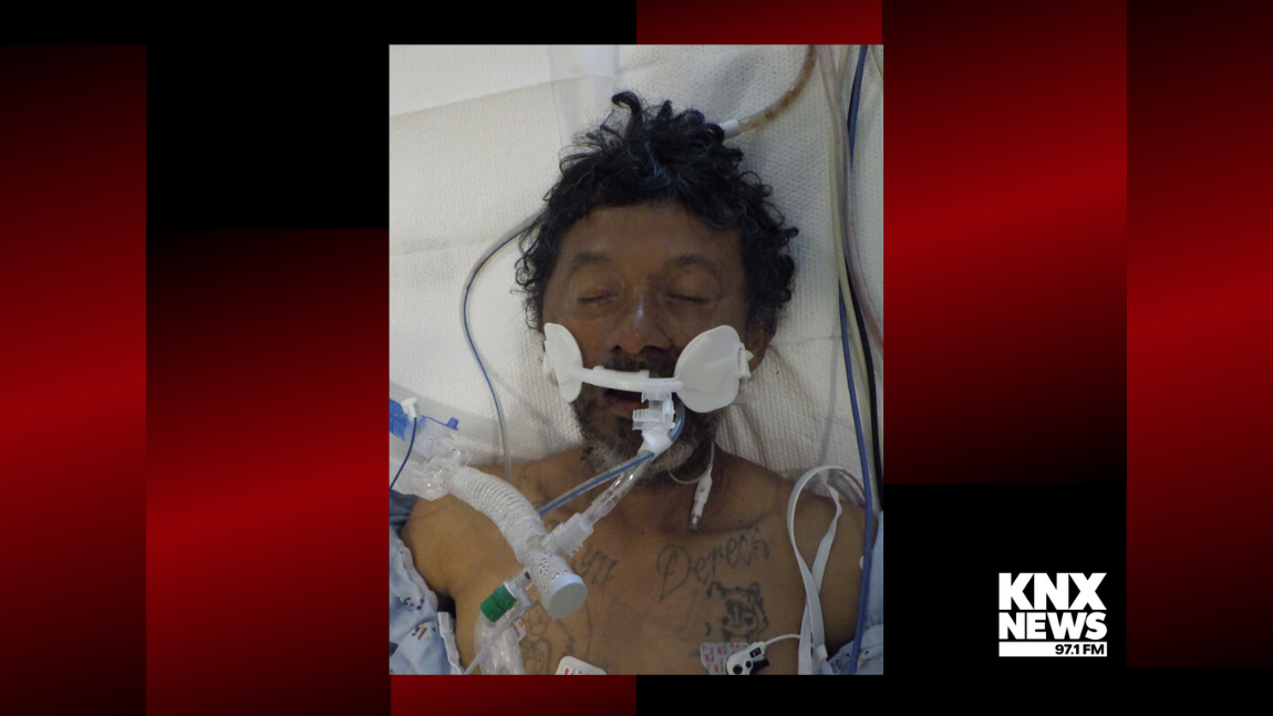 Officials seeking identity of man hospitalized at LAC+USC Medical Center