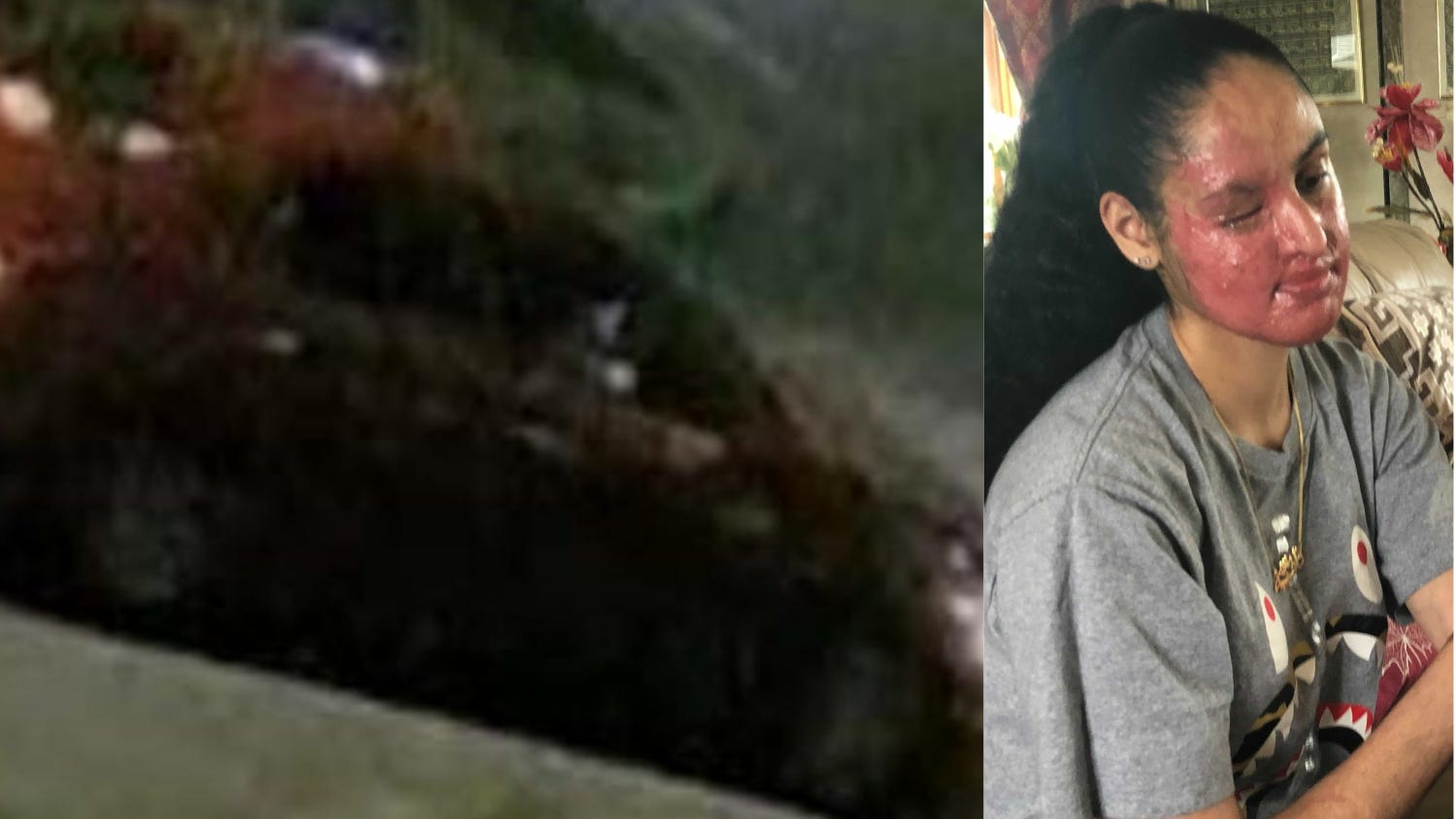 FBI offers $20K reward for info in acid attack on Hofstra student