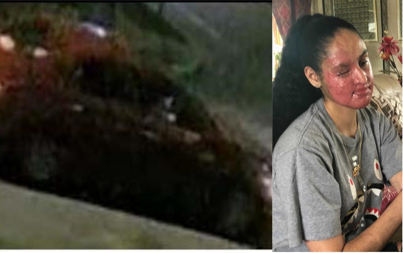 Nafiah Ikram Attack