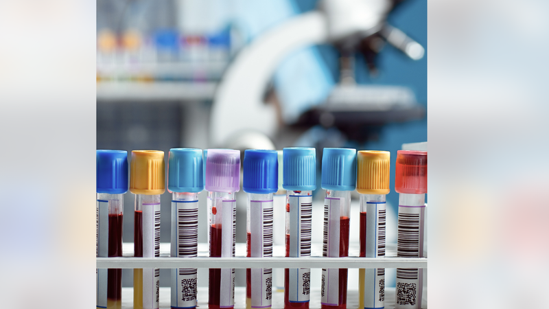 blood samples