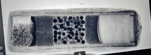 X-ray shows shrapnel inside a homemade bomb, according to police
