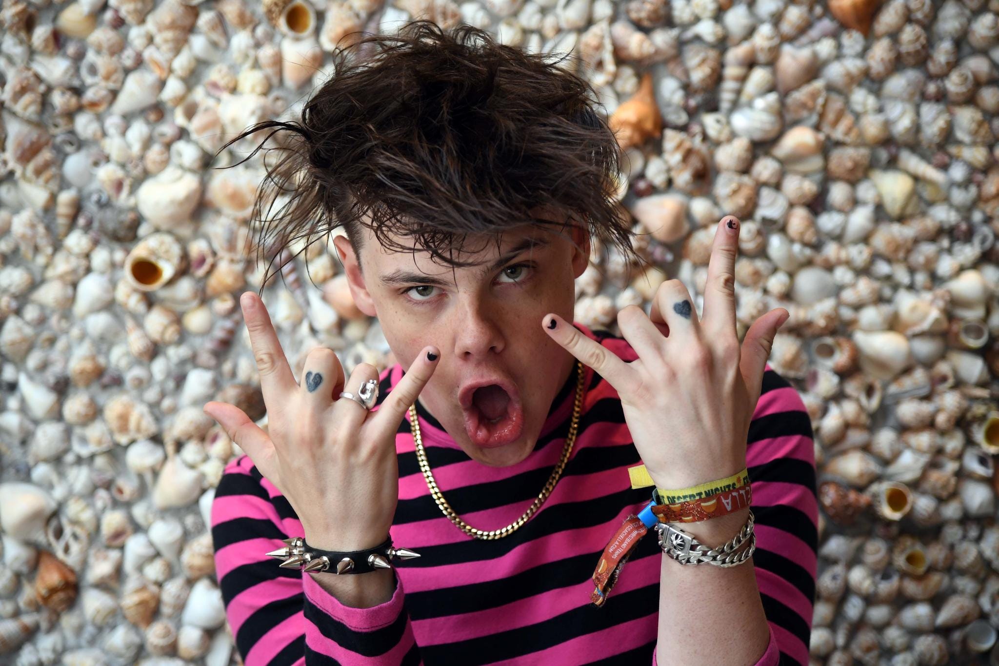 An Injured YUNGBLUD Isn't Letting Anything Stop Him from Performing