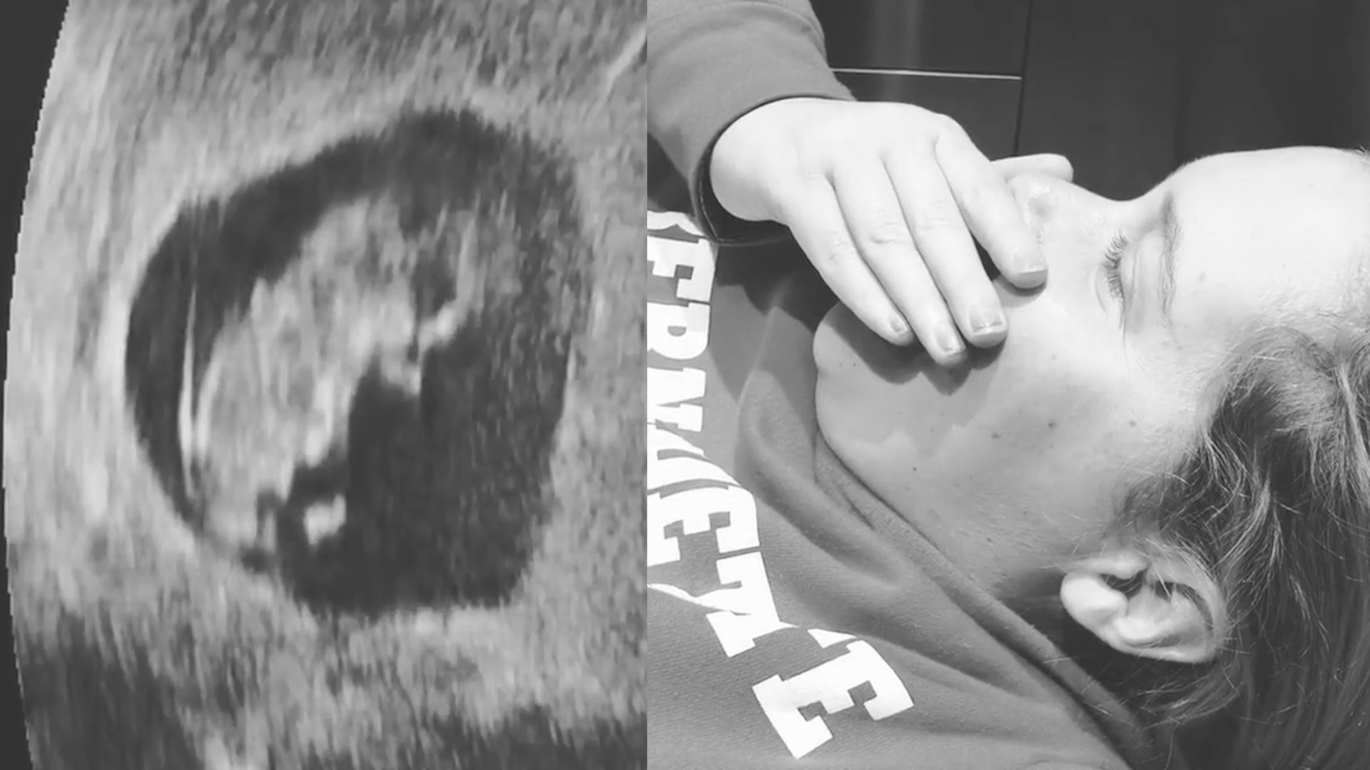 There Are Jokes and Tears of Joy at Amy Schumer’s Sonogram