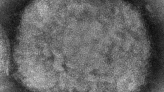 EU regulator considers clearing smallpox shot for monkeypox