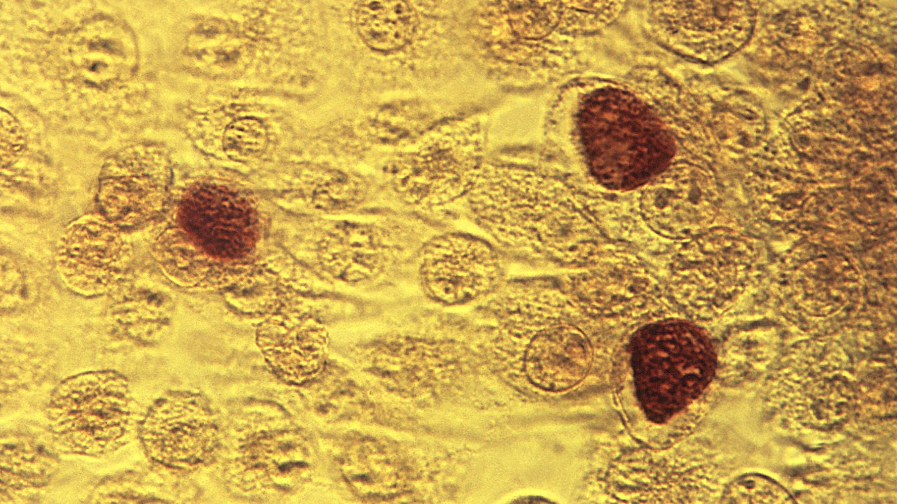 COVID testing blitz undermined screening, fight against STDs