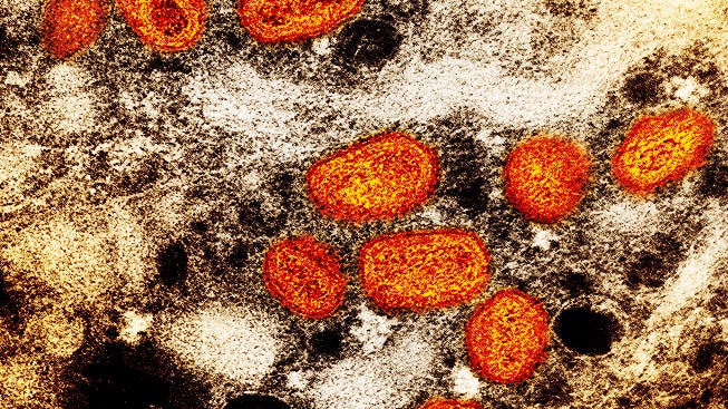 If monkeypox spreads through sexual contact, is it an STD?