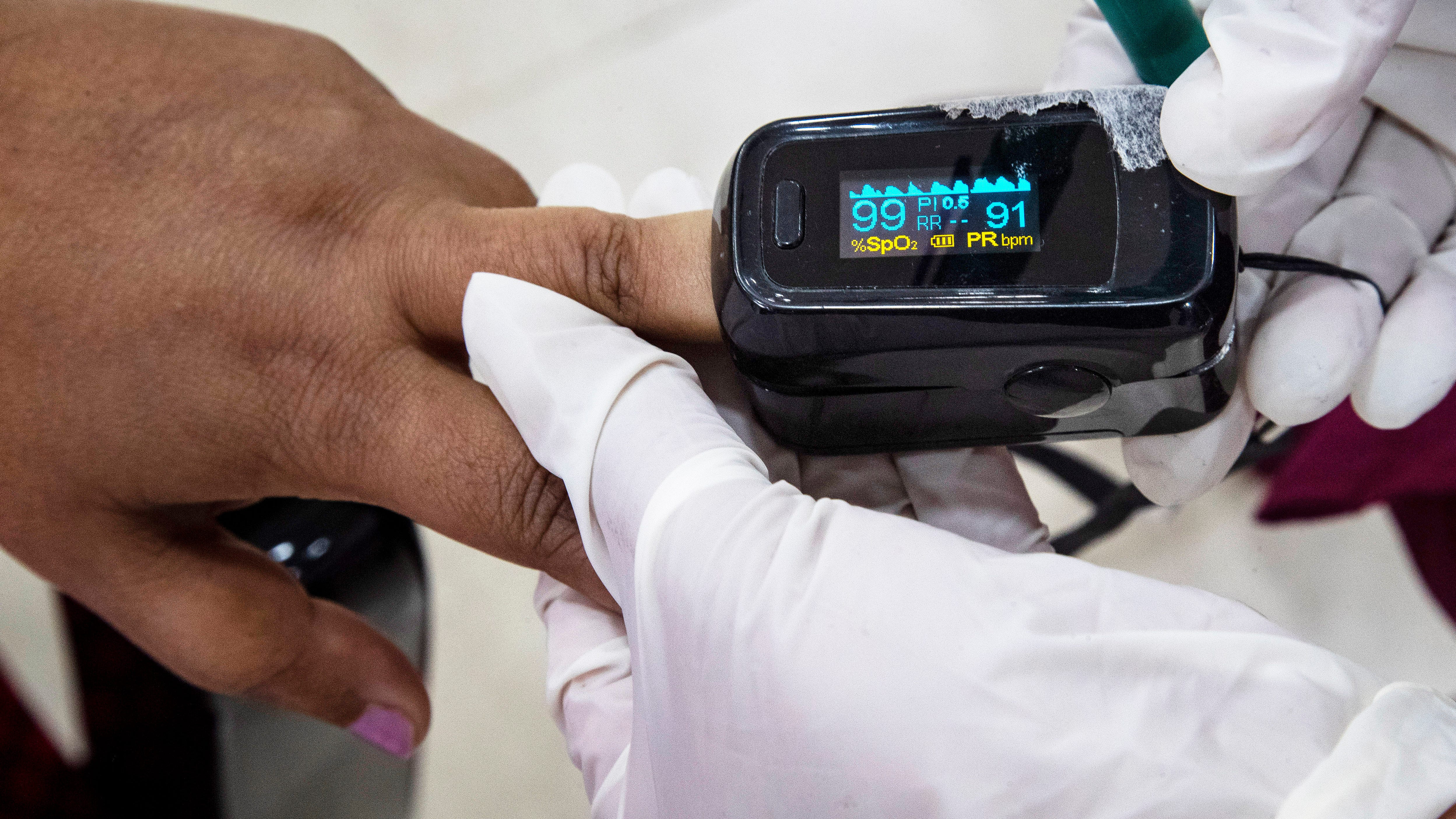 FDA advisers meet on racial disparities in pulse oximeters