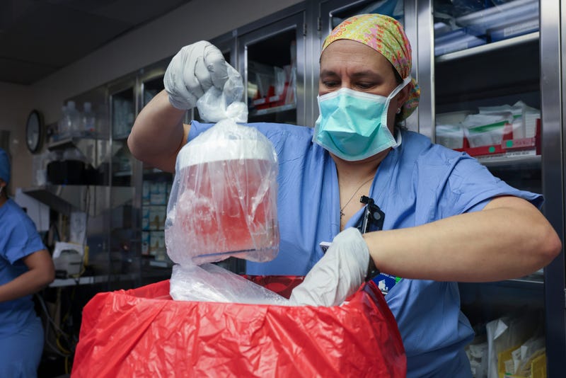 Pig Kidney Transplant