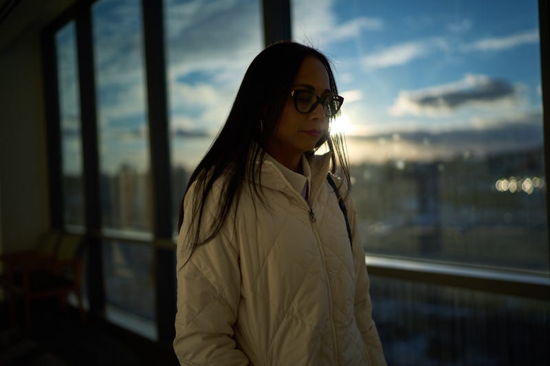 Autoimmune Diseases Lupus Photo Essay