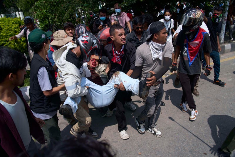 APTOPIX Nepal Protest