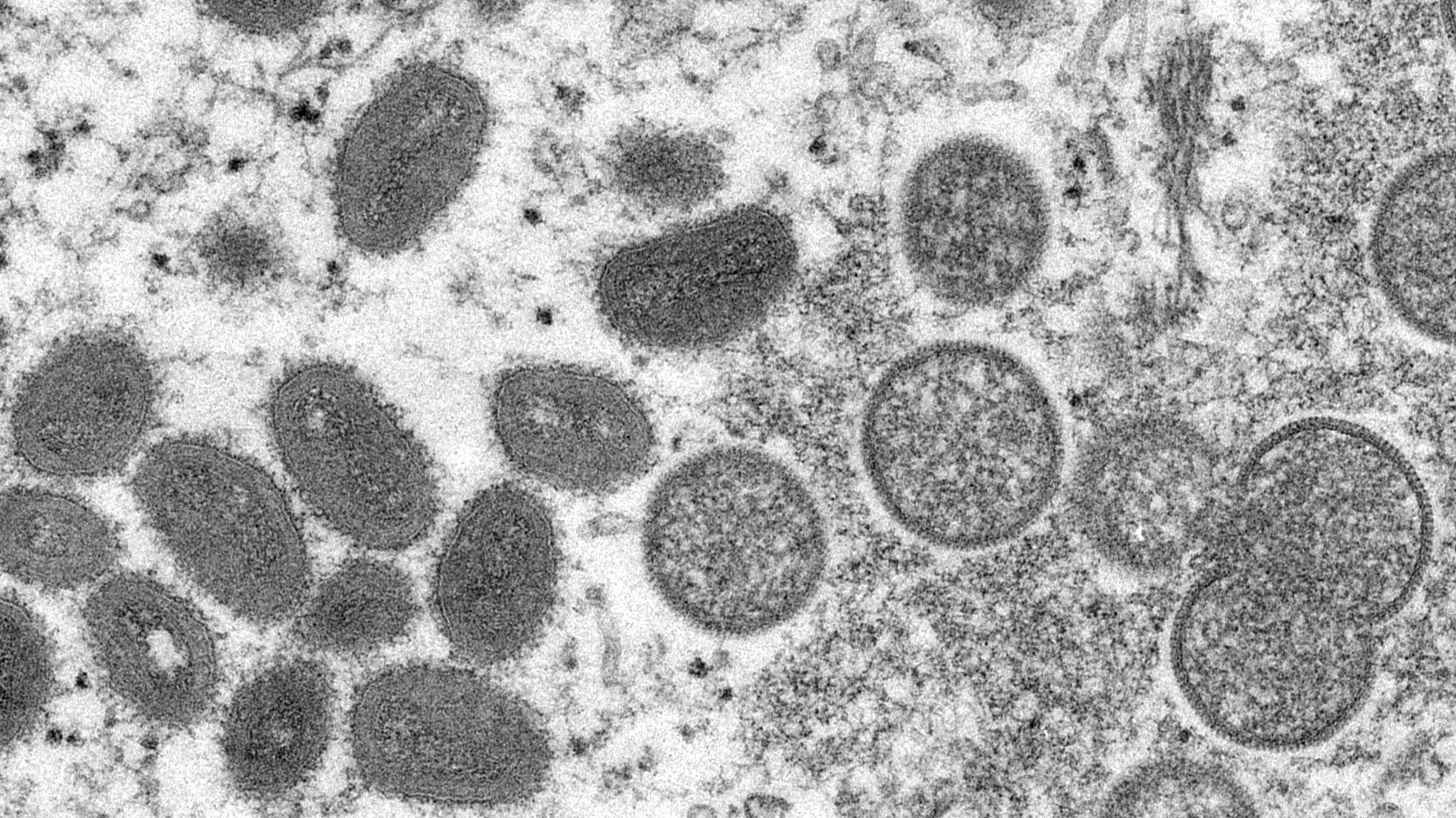 WHO to share vaccines to stop monkeypox amid inequity fears