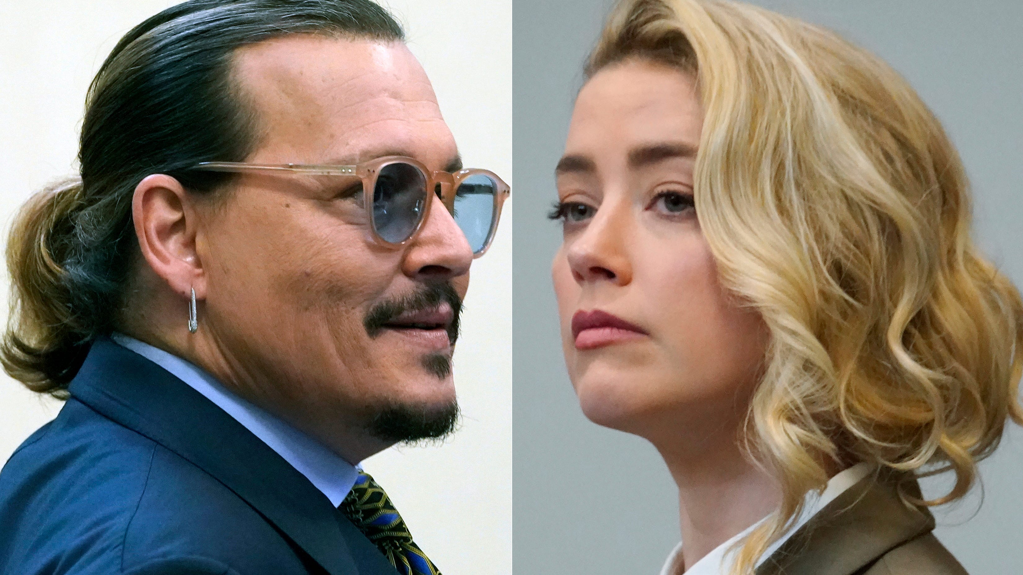Surgeon: Johnny Depp's severed finger story has flaws