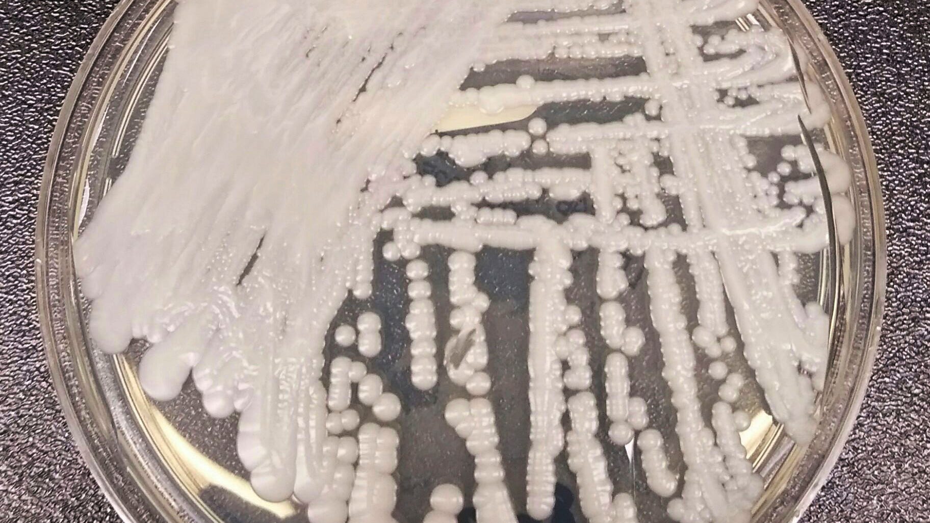 Superbug fungus cases rose dramatically during pandemic