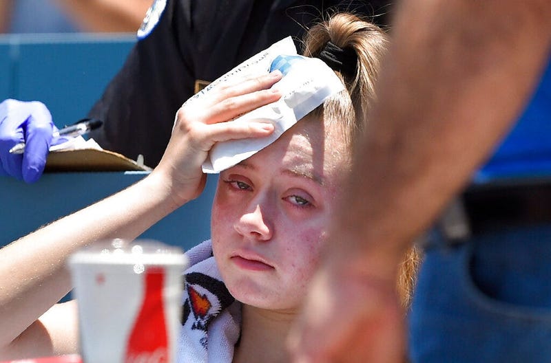 A young fan holds ice to her head after being hit with a foul ball hit by Los Angeles Dodgers' Cody Bellinger
