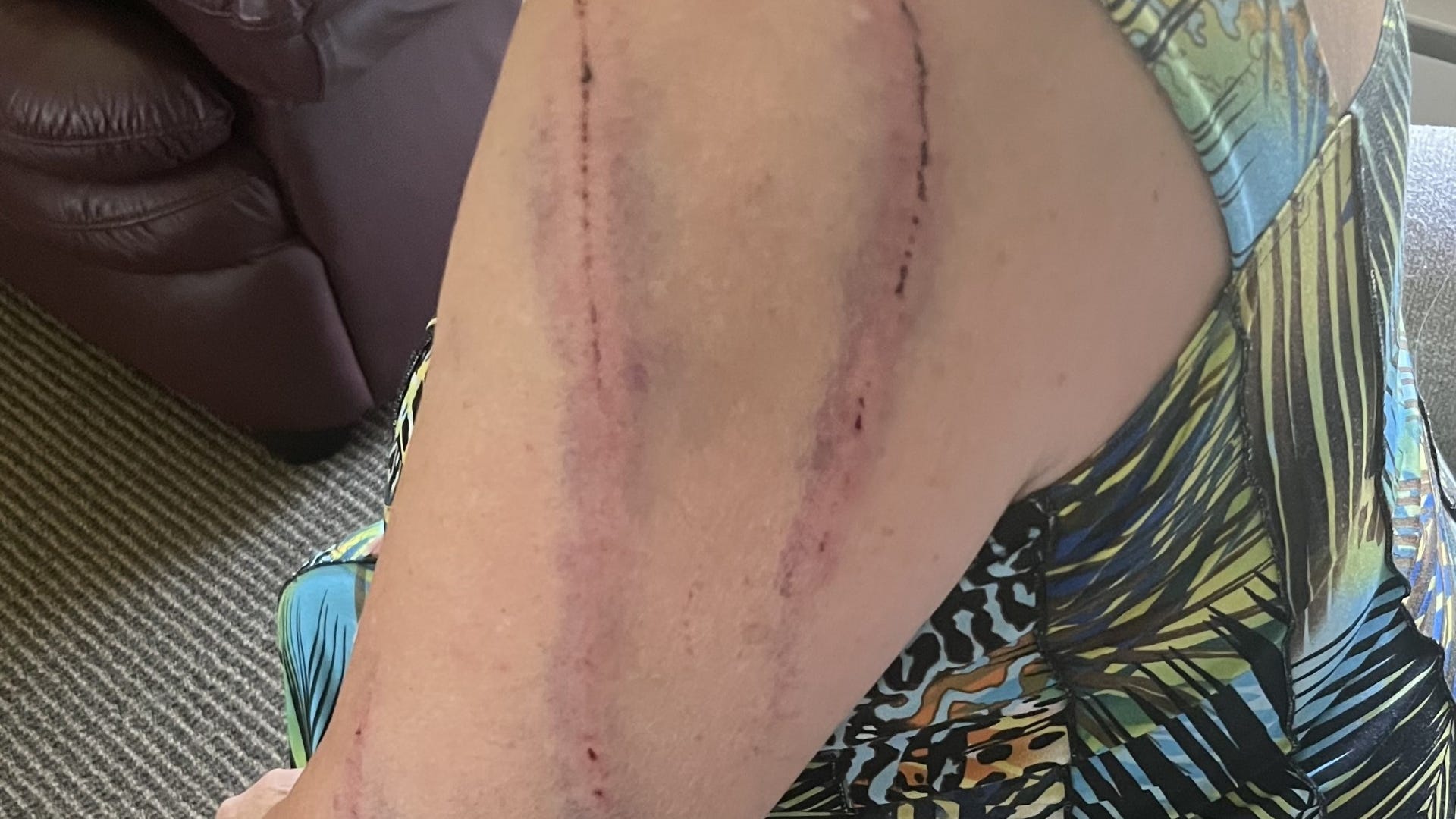Woman attacked by black bear while letting her dog outside in northern Minnesota