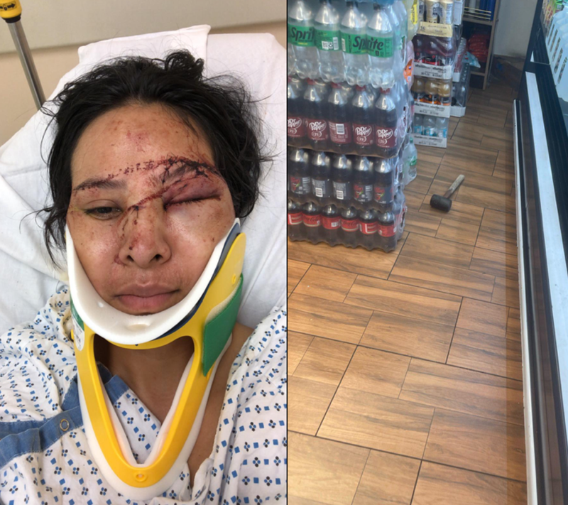 Photos from the UBA show Oralia and the hammer used in Saturday morning's attack