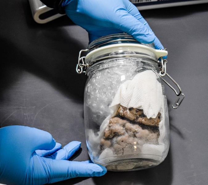Human brain discovered in shipment.