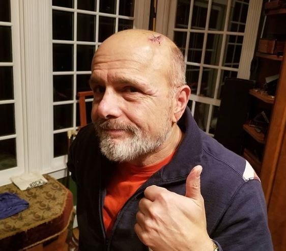 Joe Pantoliano
