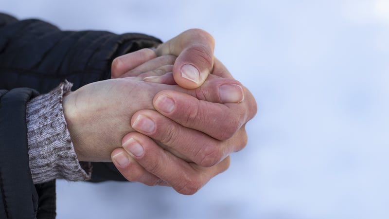 Cold hands