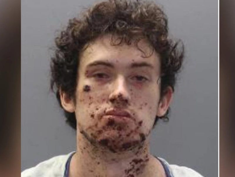 Cole Carini of Richlands is accused of lying to feds about posessing explosives and injuries sustained in an explosion