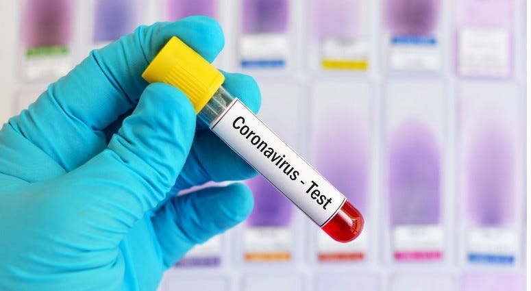 coronavirus test