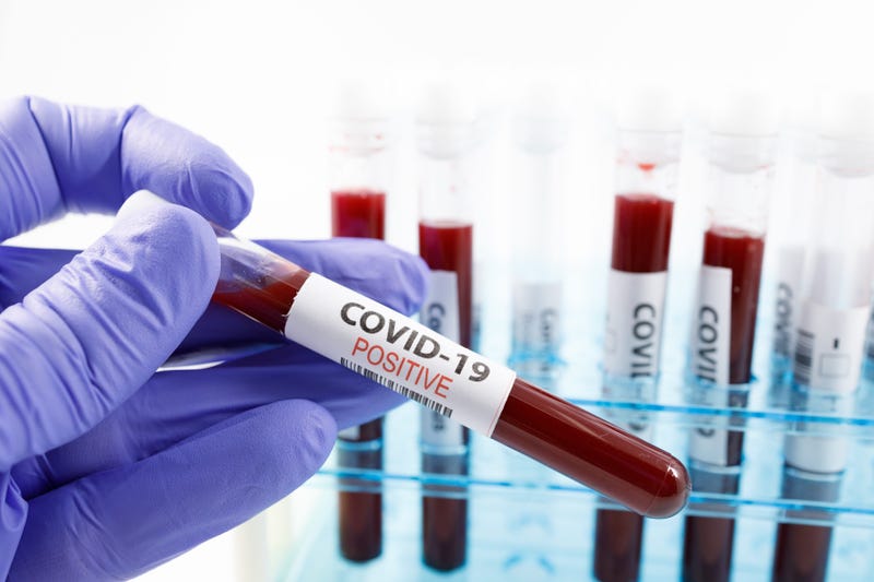 Close up of microbiologist hand with surgical gloves holding a positive blood test result for coronavirus