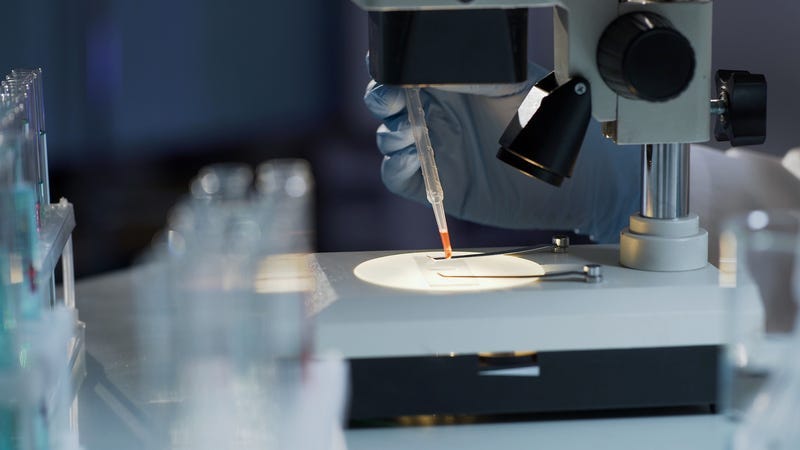 HIV infection test, analysis