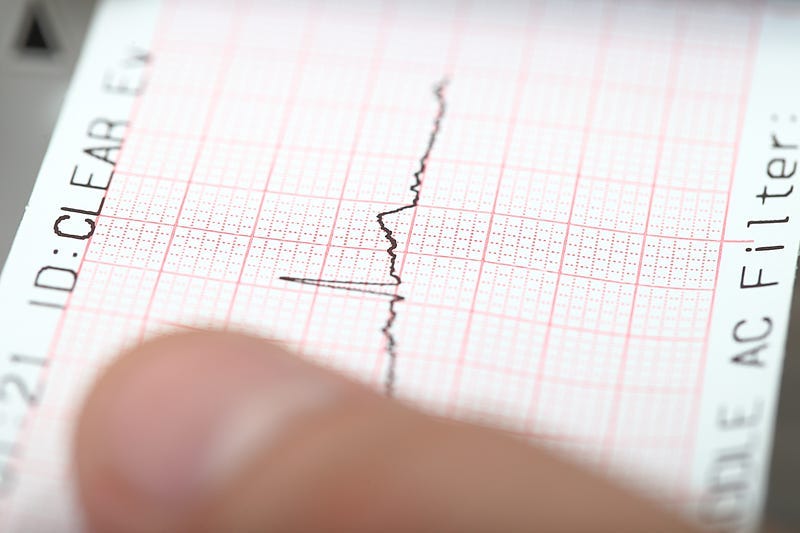 Earthquake, seismograph
