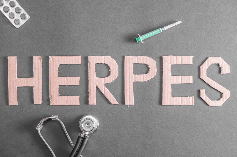 herpes
