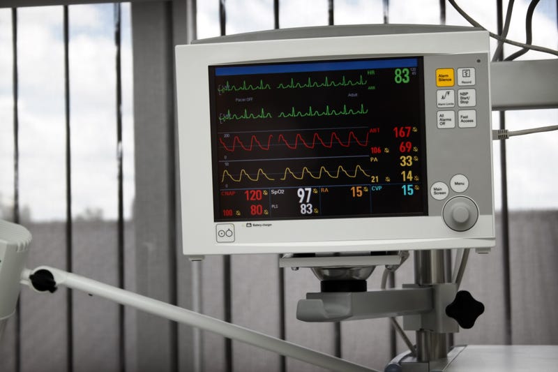 EKG readout on computer screen