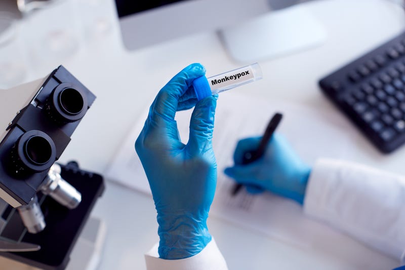 monkeypox test in a lab