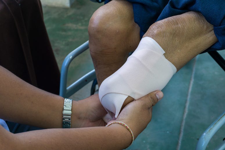 Elastic Bandages, Amputed Leg