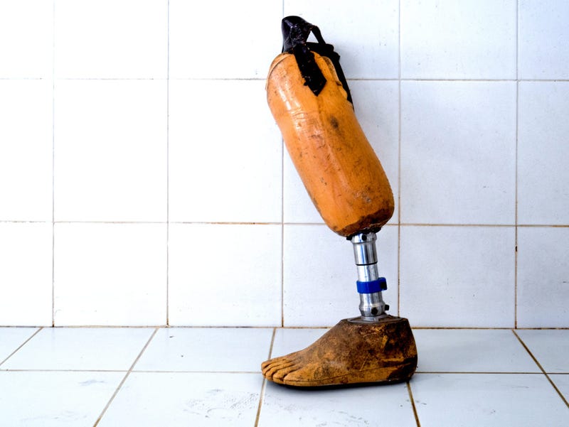 prosthetic leg