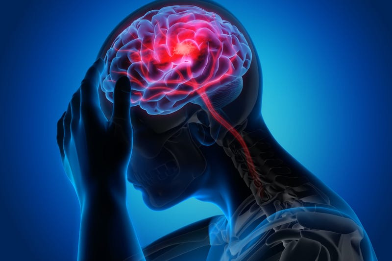 stroke-GettyImages-1168179082.jpg