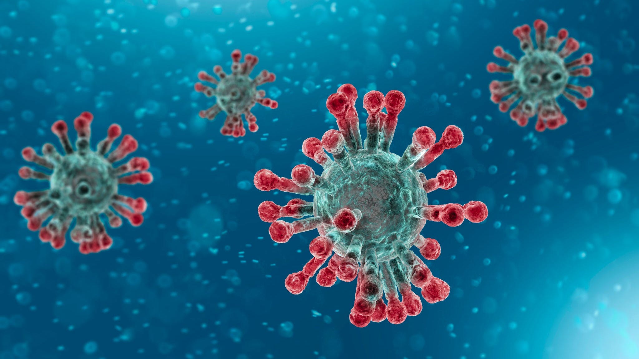 COVID-19 Cases Top 3 Million In U.S. As Infections Continue To Spike