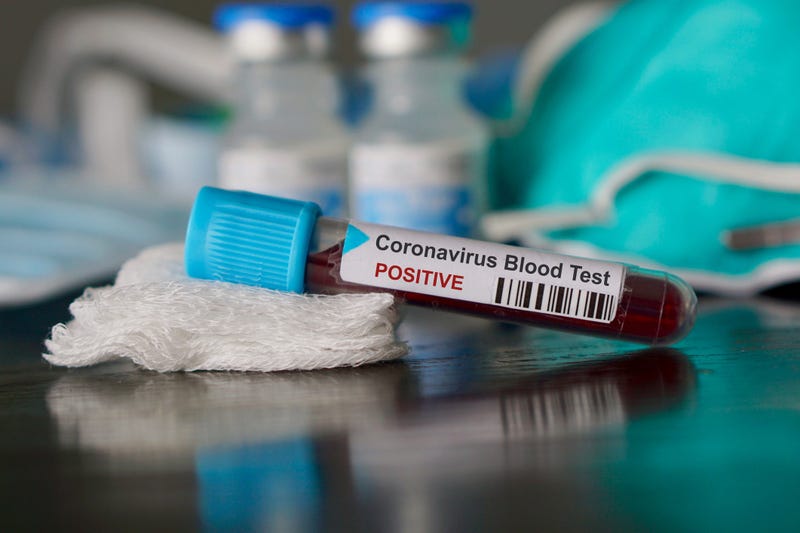 coronavirus, positive test