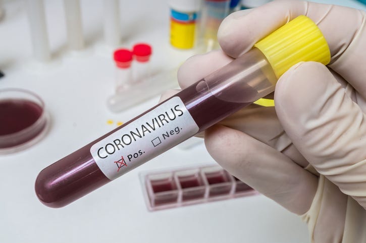 Coronavirus 2019-nCOV analysis
