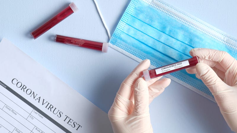 Coronavirus-Test