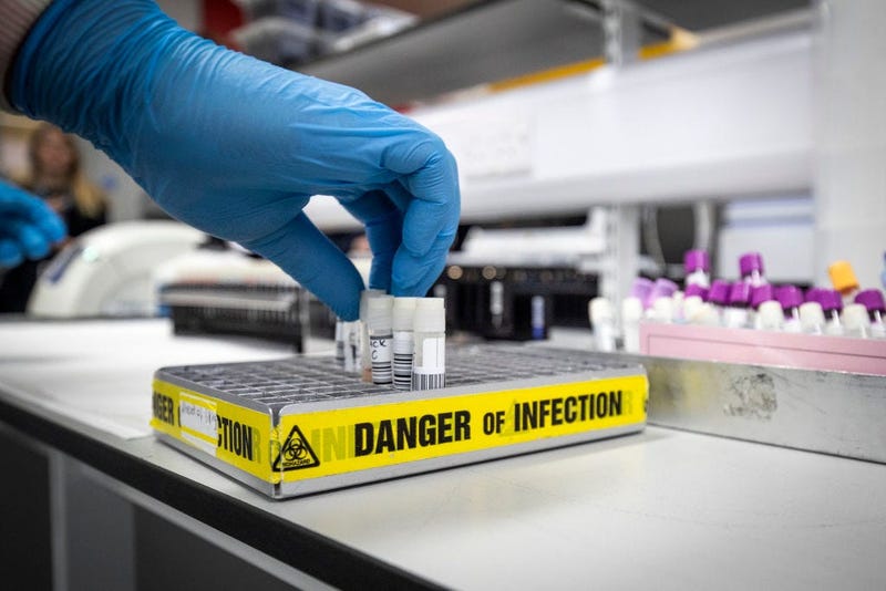 coronavirus, infection, testing