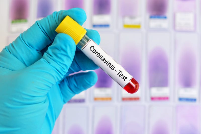 The First ICE Detainee Tests Positive for Coronavirus 