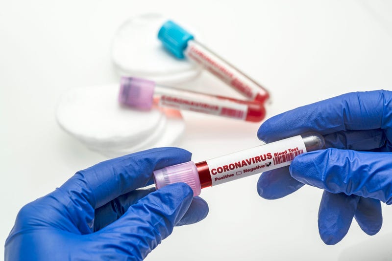 Covid-19 coronavirus test stock photo