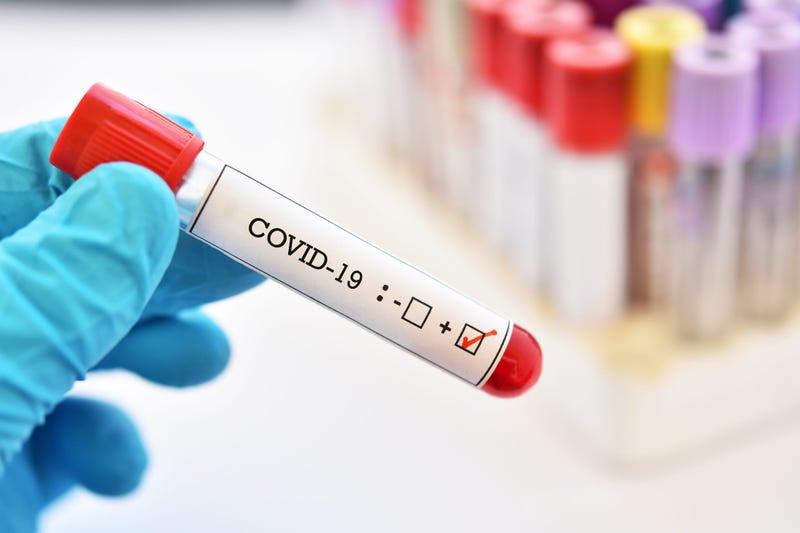 Coronavirus Test