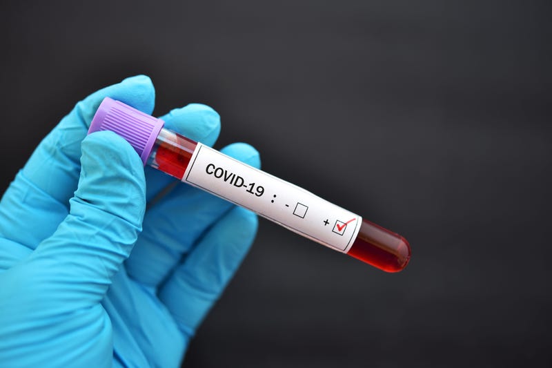 Why The Trump Administration Lacked Preparation for the Coronavirus