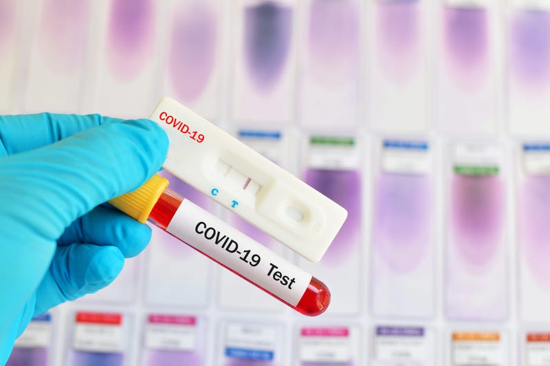 Coronavirus