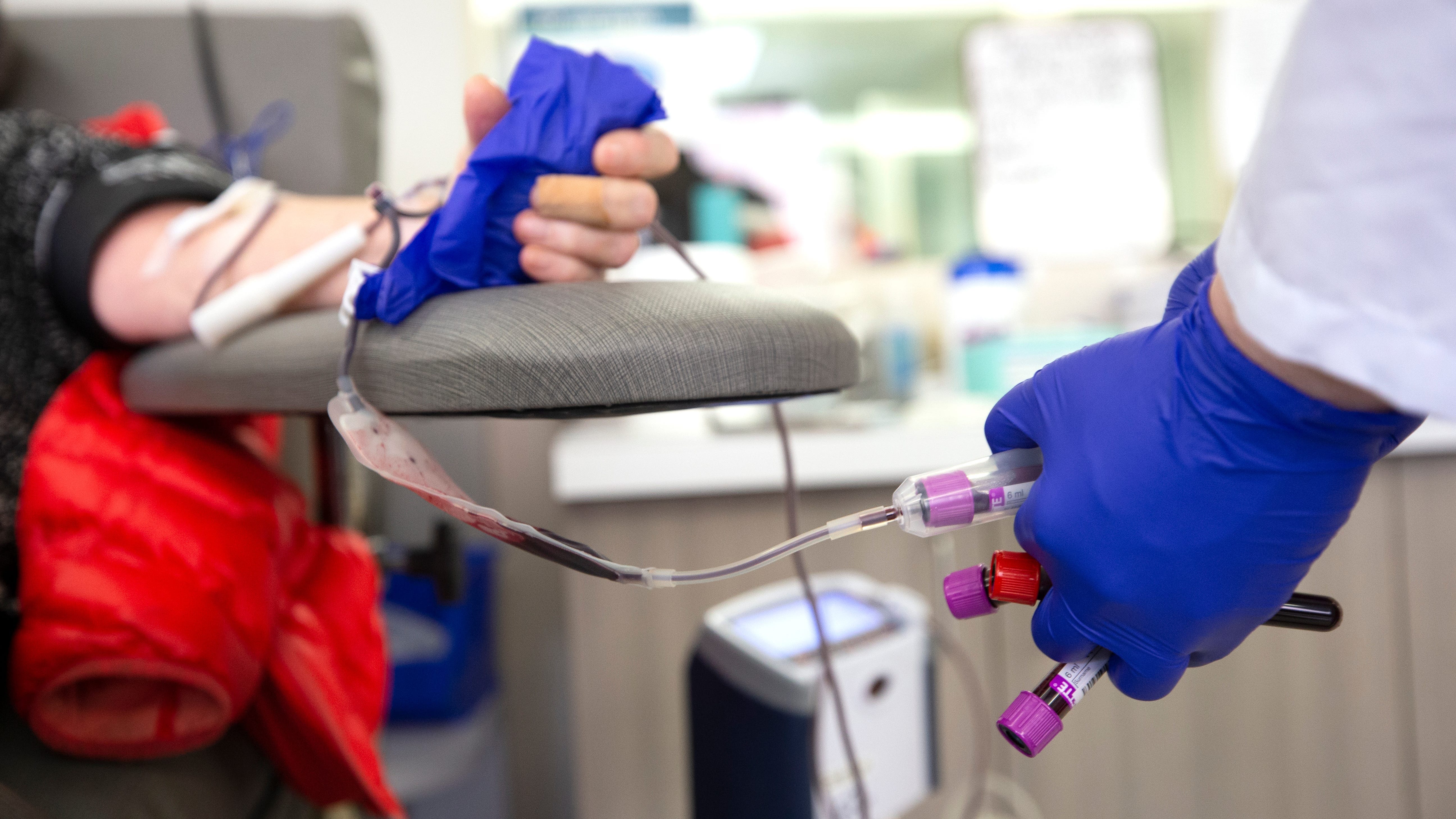 FDA loosens restrictions on blood donations from gay, bisexual men