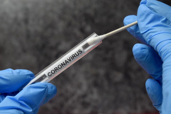 A COVID-19 test